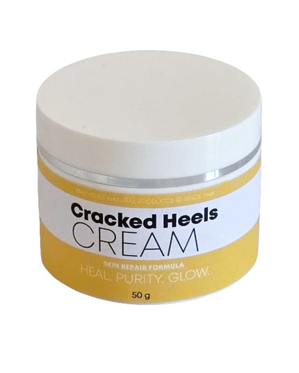 Cracked Heels Cream