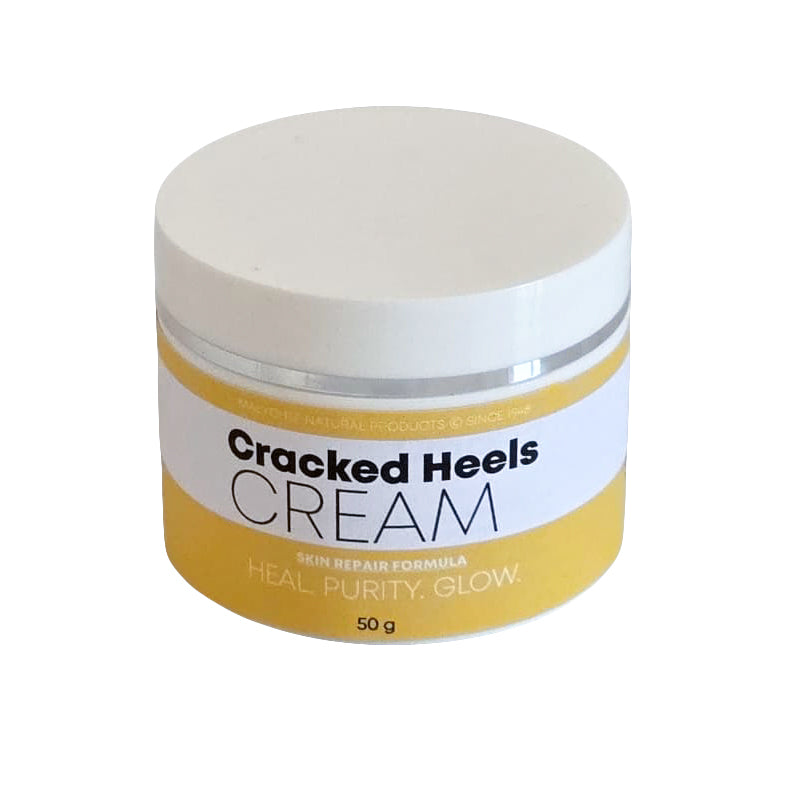 Cracked Heels Cream